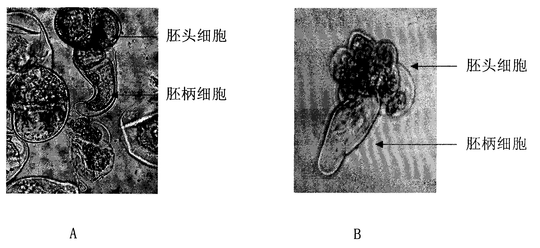 Succeeding preservation method for embryogenic callus of China fir and subculture medium used therein
