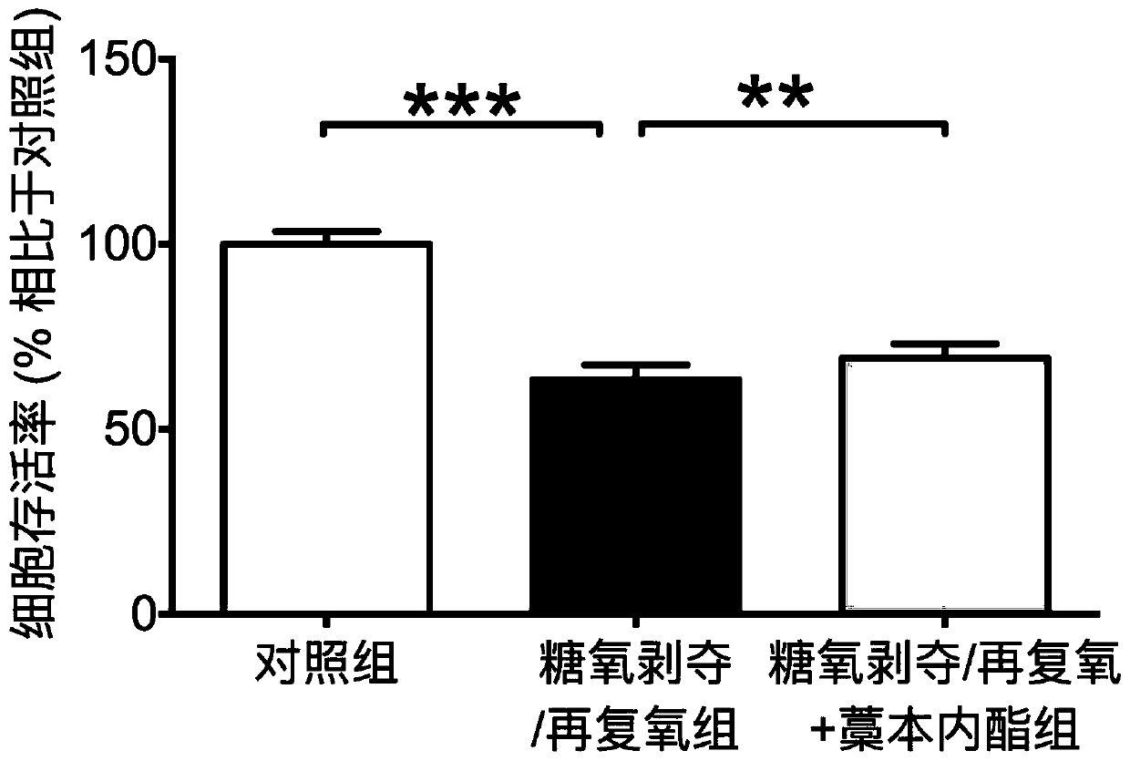 Application of ligustilide in preparing medicine for alleviating microglial cell damage, preventing and treating cerebral arterial thrombosis or repairing cerebral injury