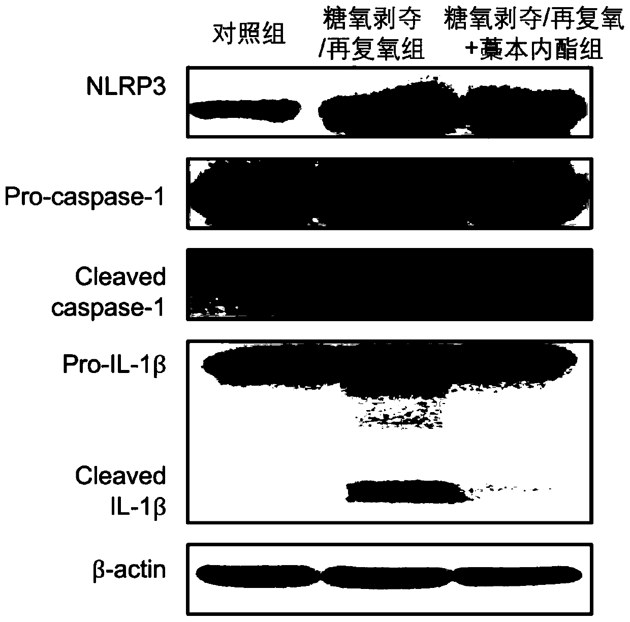 Application of ligustilide in preparing medicine for alleviating microglial cell damage, preventing and treating cerebral arterial thrombosis or repairing cerebral injury