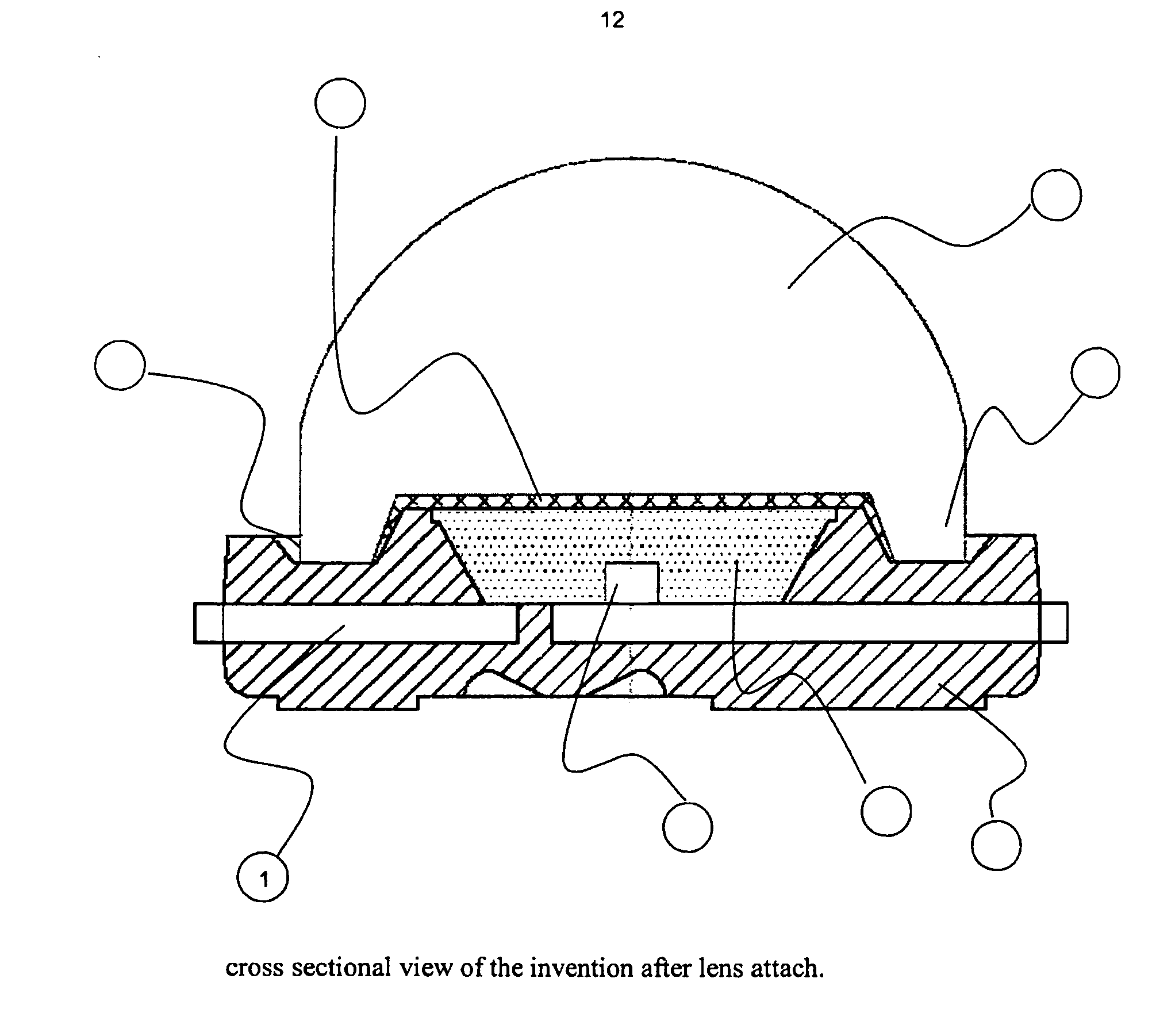 Surface mount optoelectronic component with lens