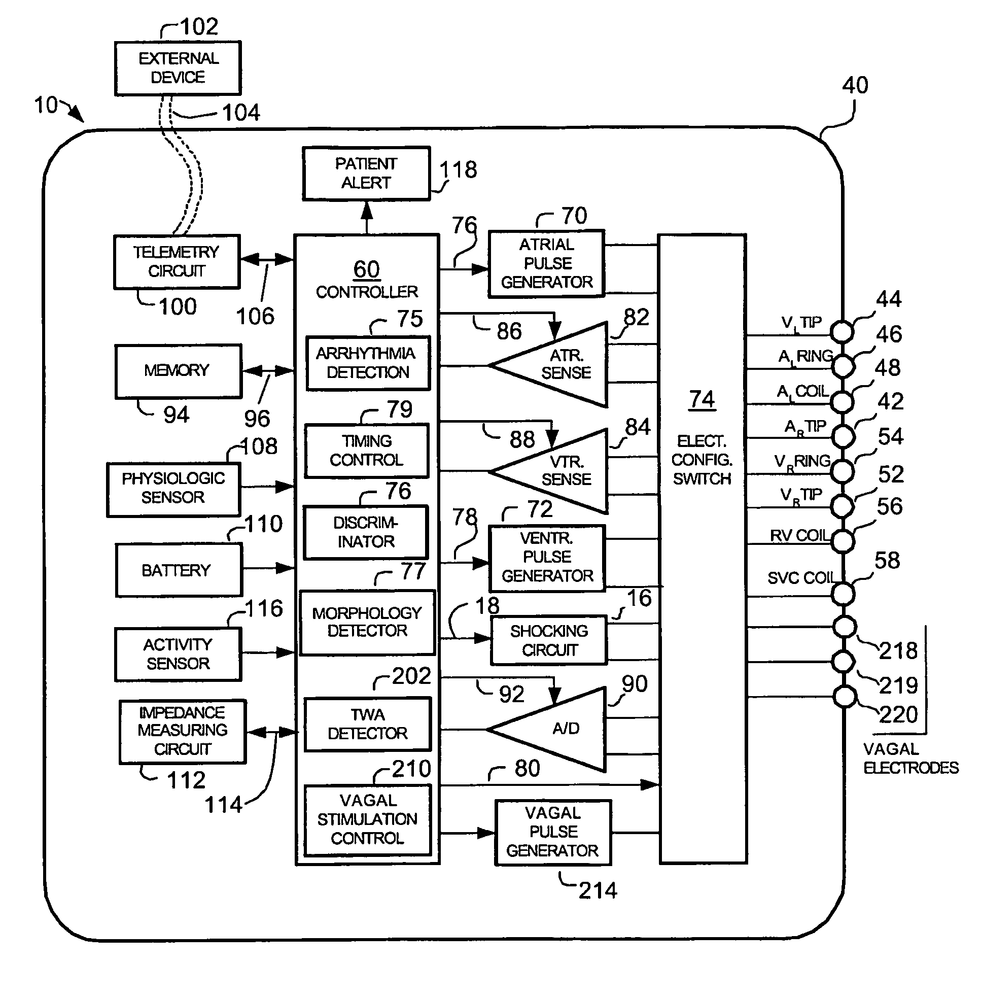 Methods and systems for analyzing T-wave alternans