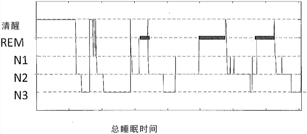 Device and method for sleep monitoring