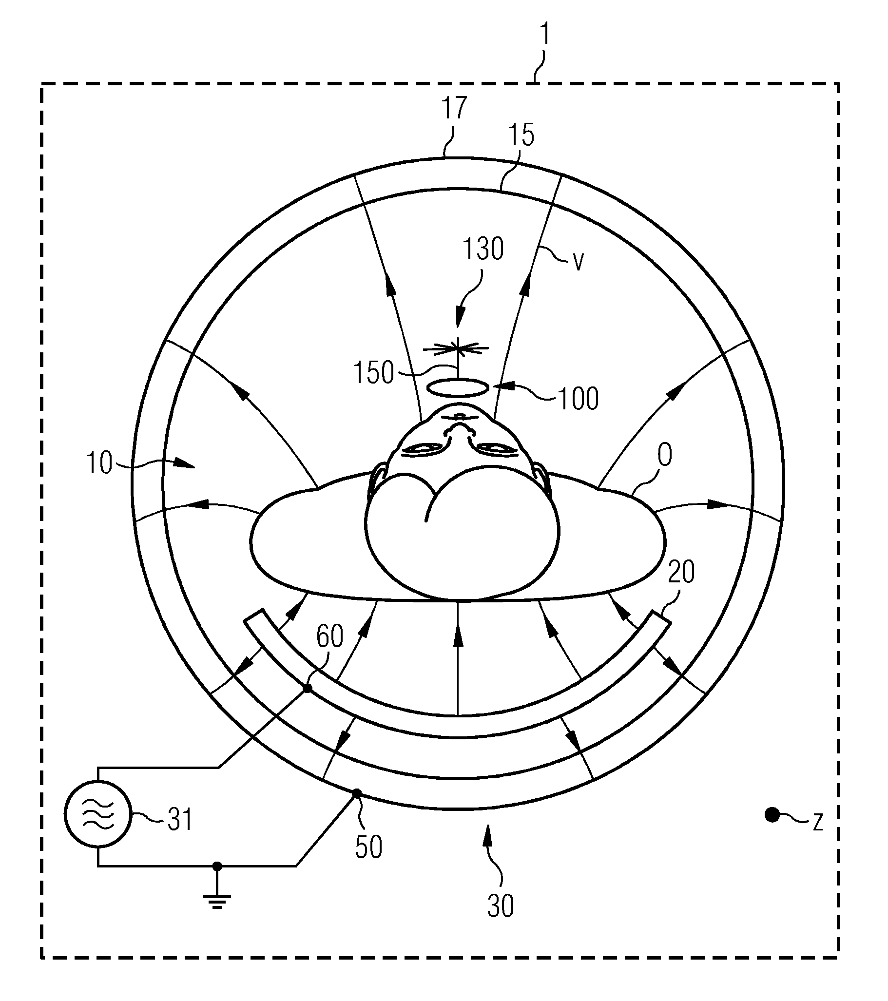 Local Coil for a Magnetic Resonance Imaging System and Magnetic Resonance Imaging System