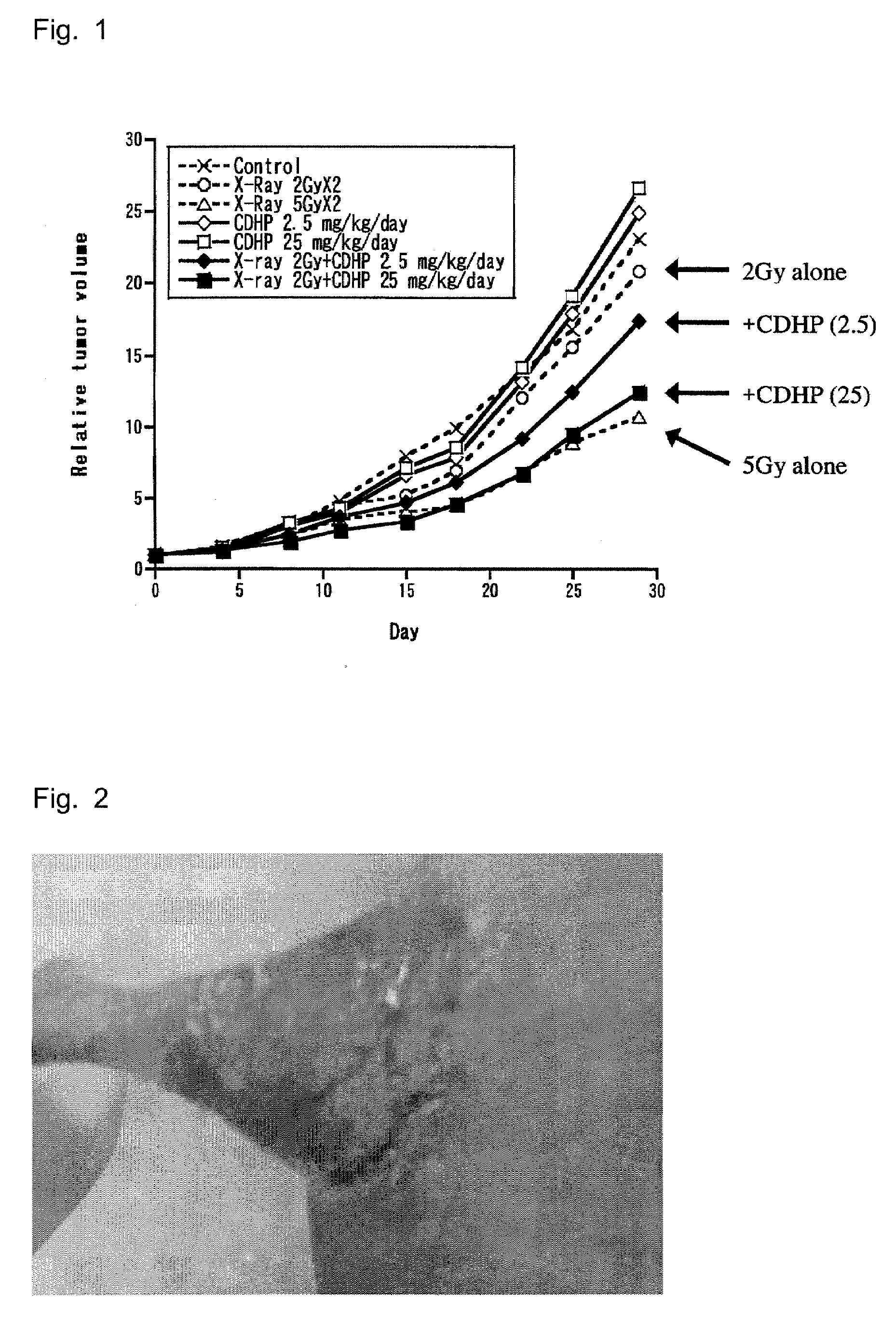Potentiator for radiation therapy comprising pyridine derivative as active ingredient