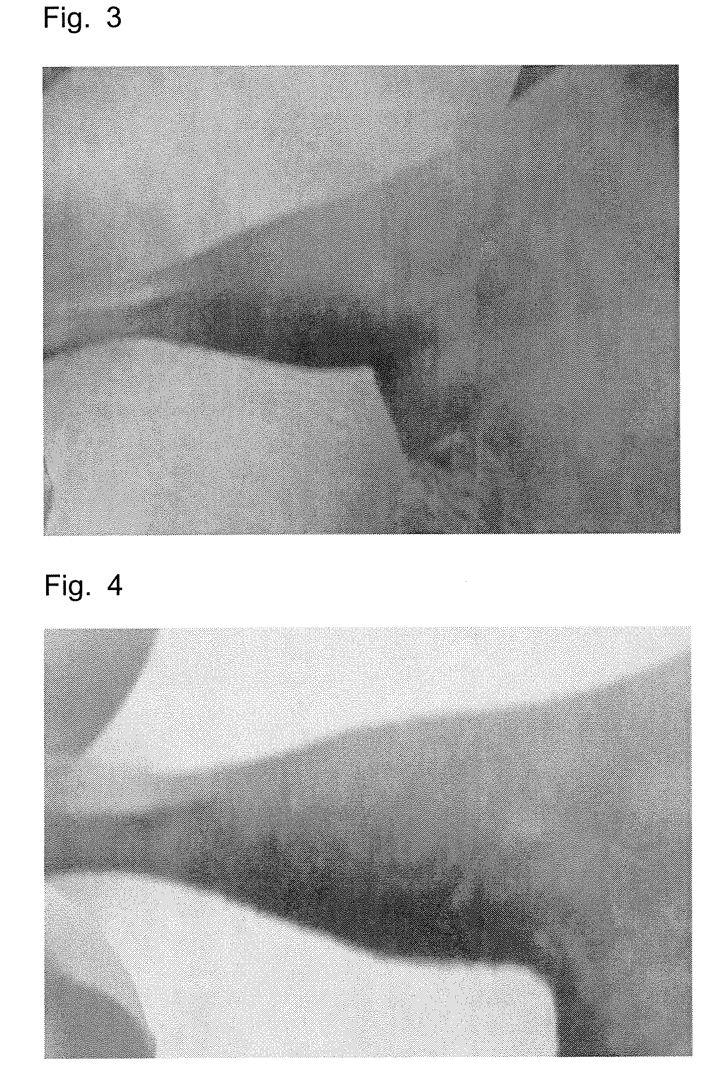 Potentiator for radiation therapy comprising pyridine derivative as active ingredient