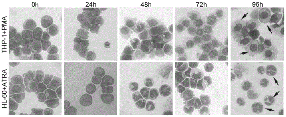 Application of mir-638 in anti-acute myeloid leukemia