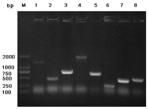 A kind of gene expression product blsj-1 of Brucella diagnostic mark function and preparation method thereof