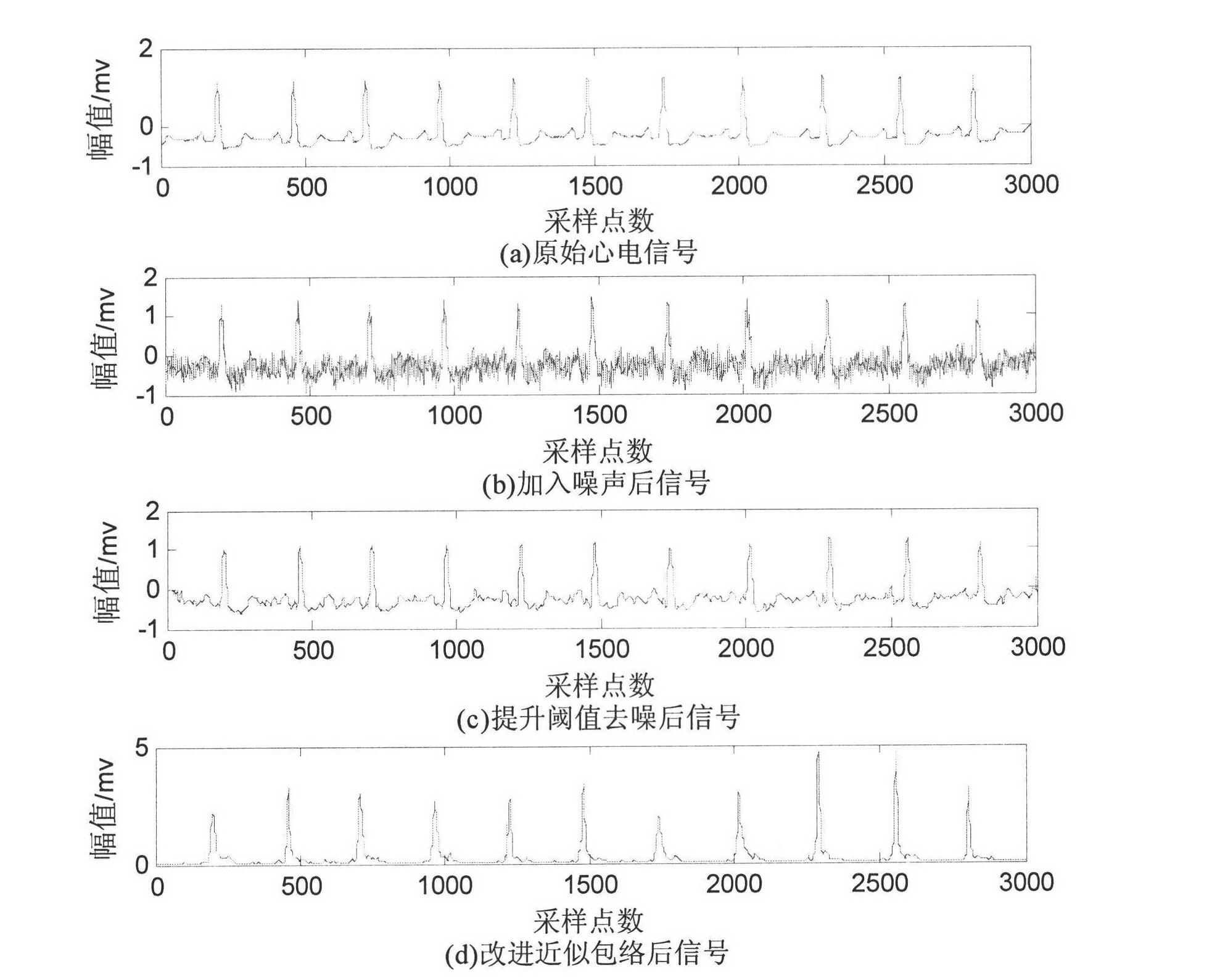 Electrocardiogram signal feature detection algorithm based on wavelet transformation lifting and approximate envelope improving