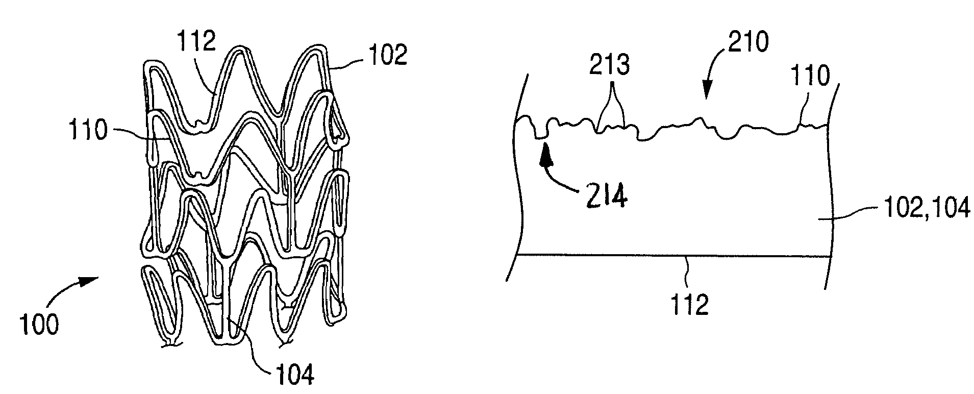 Method and system for creating a textured surface on an implantable medical device