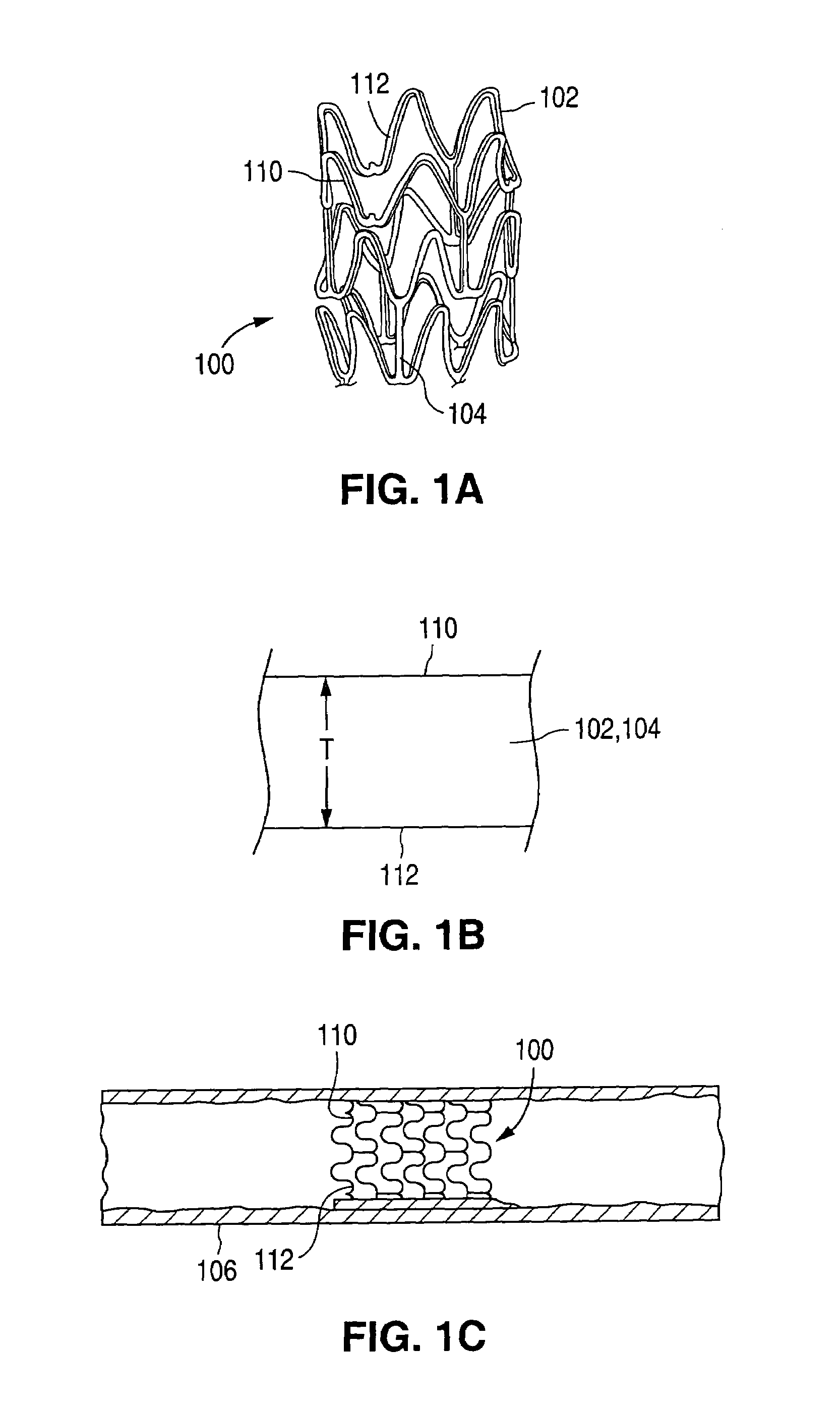 Method and system for creating a textured surface on an implantable medical device