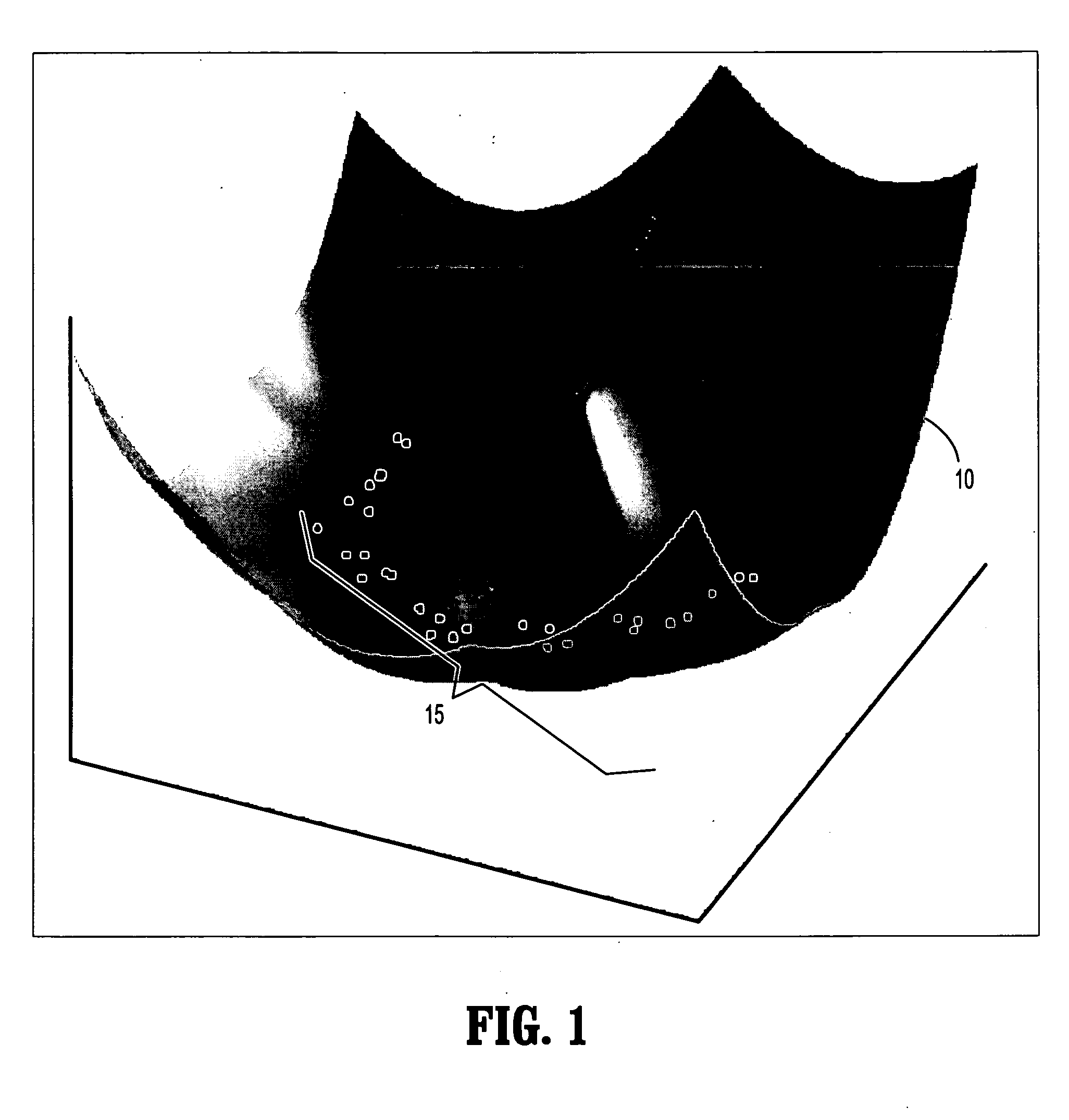 System and method for image registration using nonparametric priors and statistical learning techniques