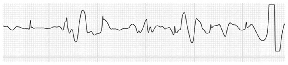 Data acquisition method, device, smart wearable device and storage medium