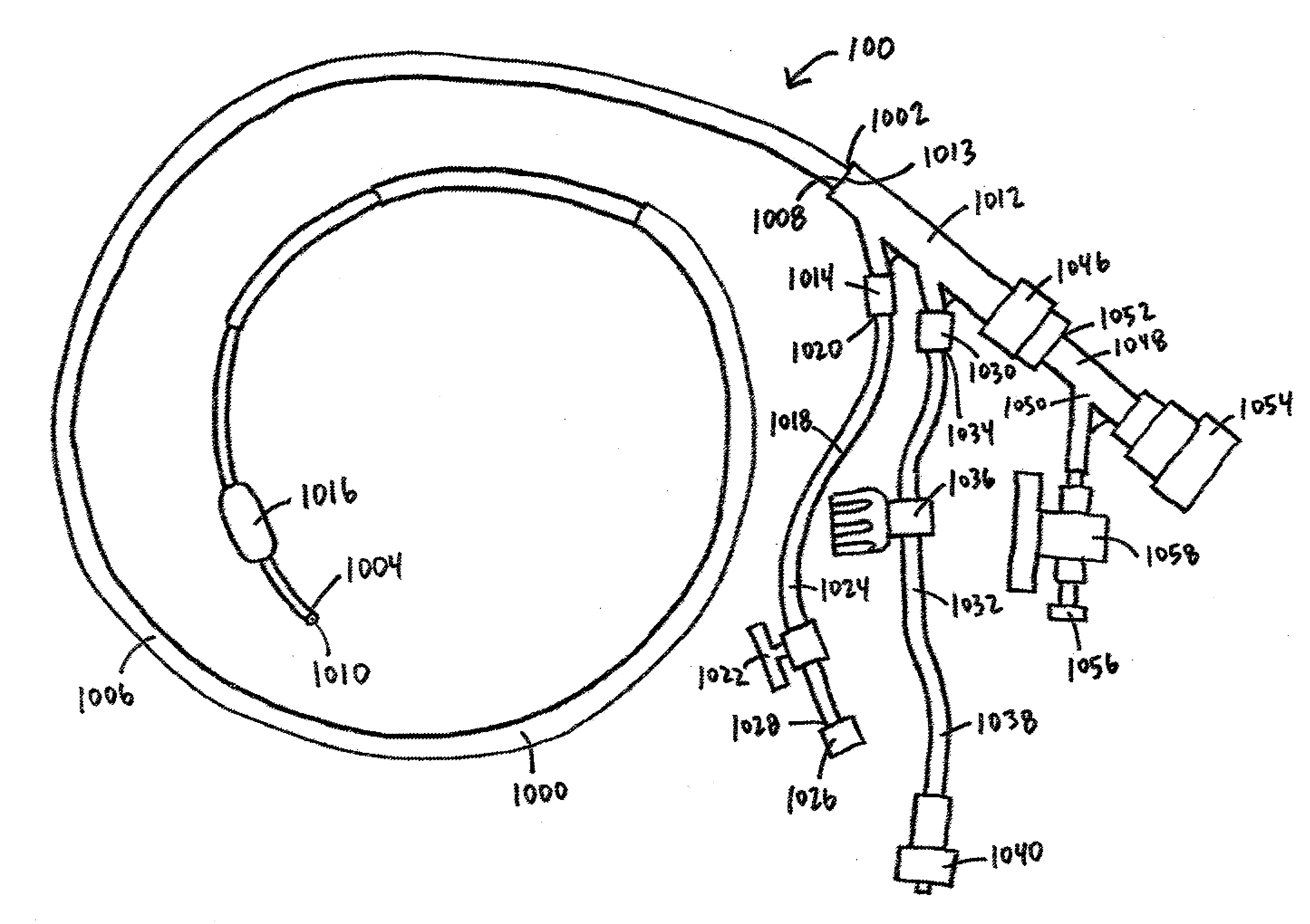Devices, systems, and methods for organ retroperfusion