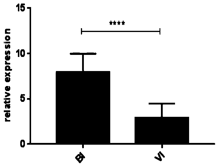 Use of IFI44L gene and PI3 gene in preparation of diagnostic bacterial/viral infection kit