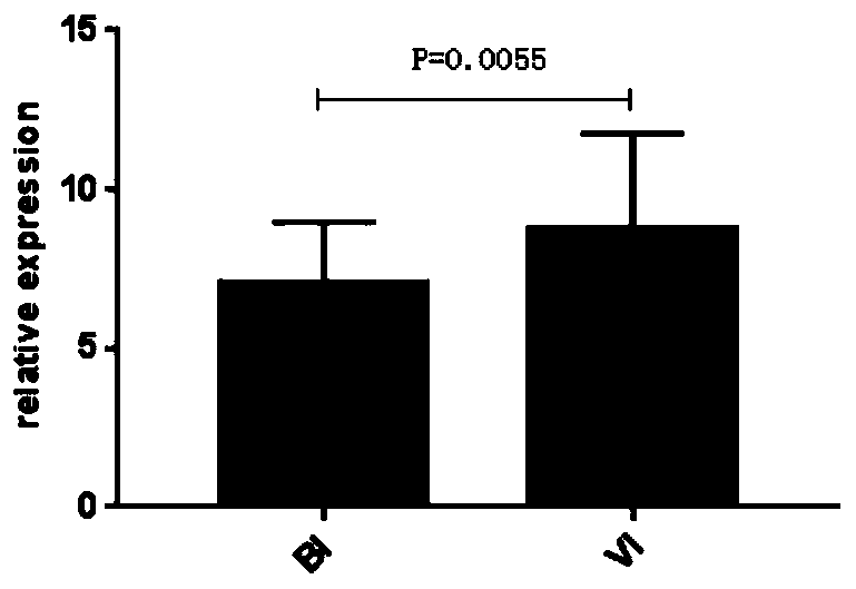 Use of IFI44L gene and PI3 gene in preparation of diagnostic bacterial/viral infection kit