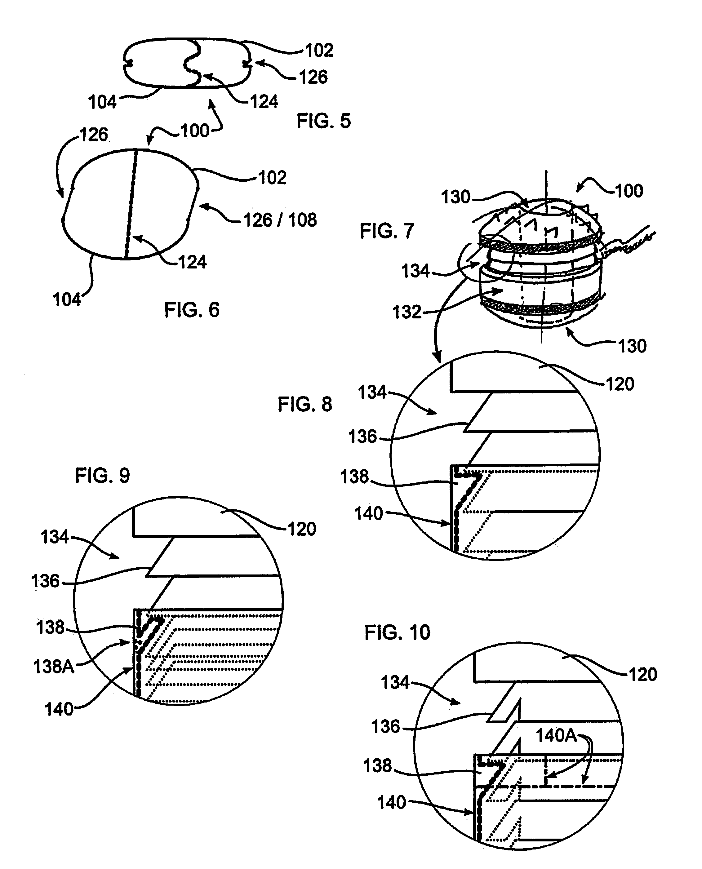 Stabilizing Vertebrae with Expandable Spacers
