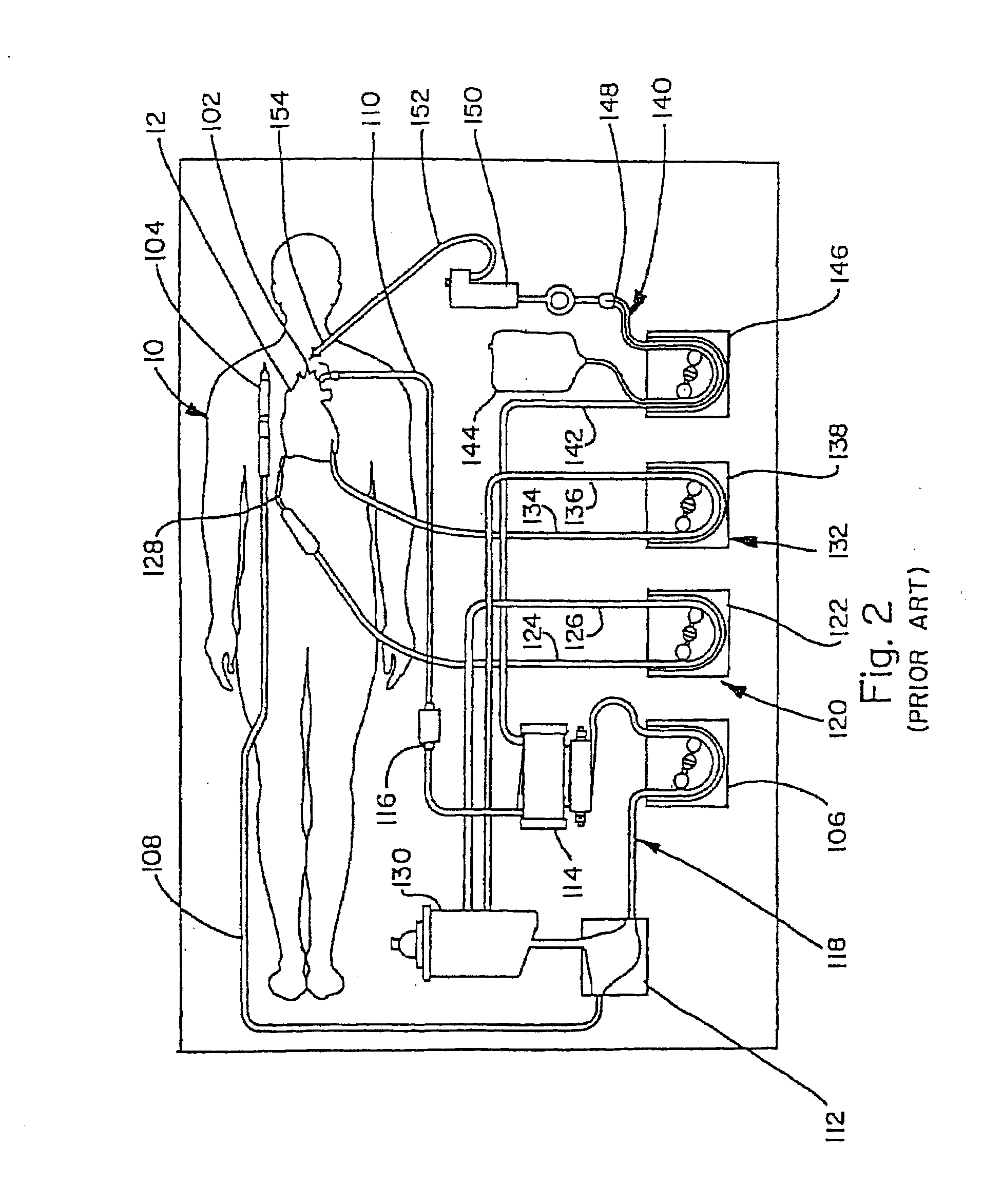 CPB Pump System With Double Y Tubing