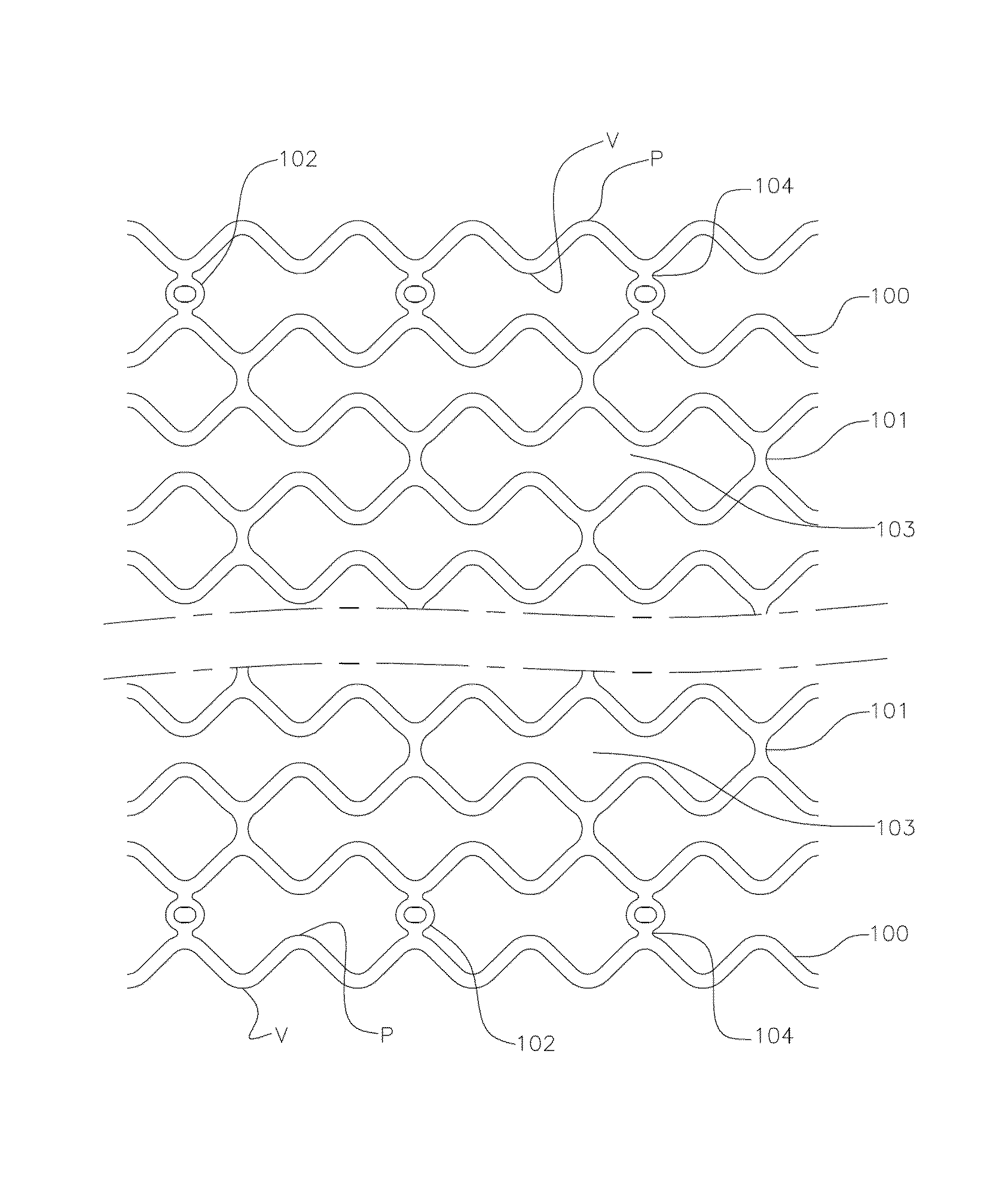 Thin strut stent from bioabsorbable polymer with high fatigue and radial strength and method to manufacture thereof