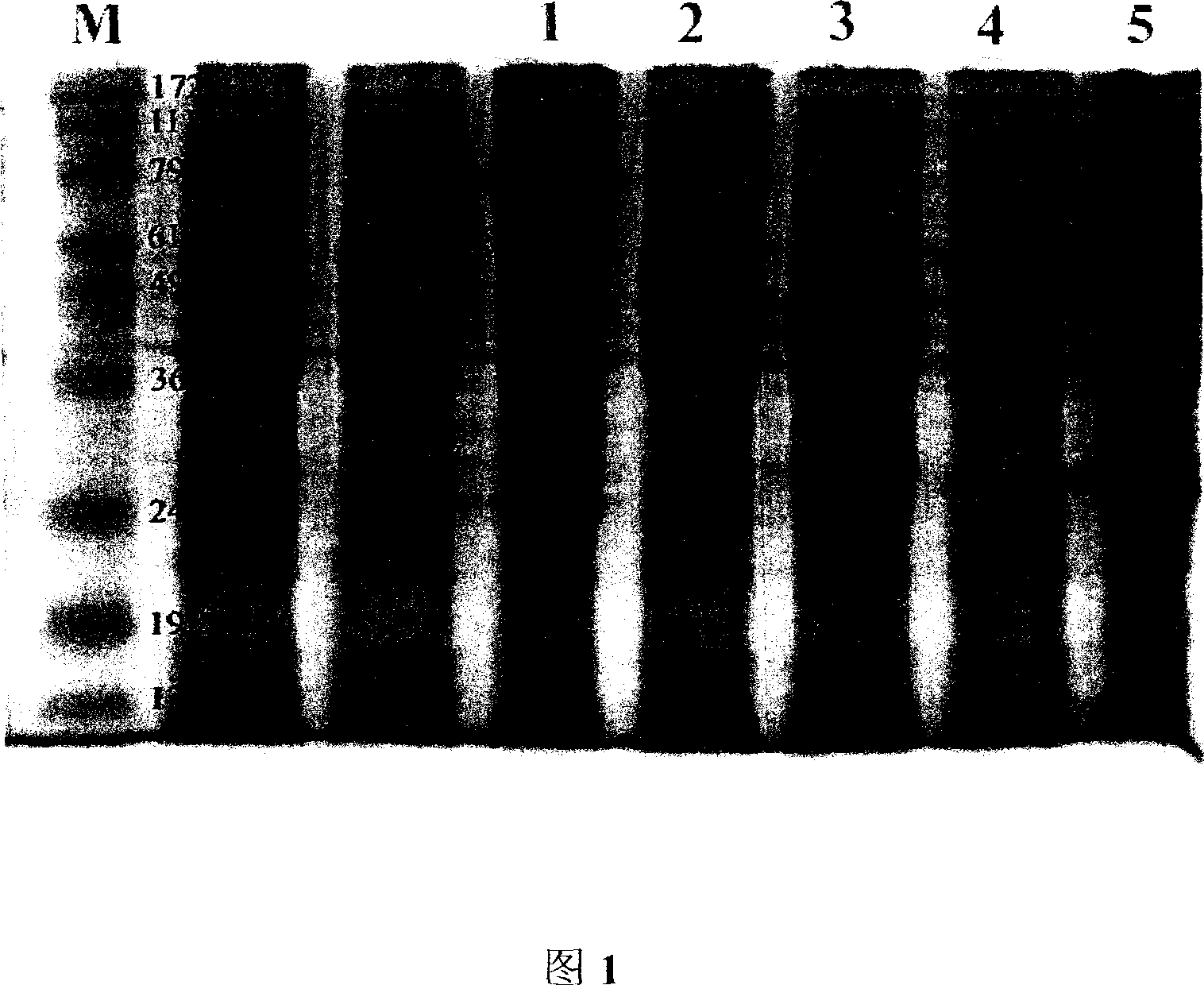 Cloning of Japanese blood fluke vaccine antigen gene and its expression and application