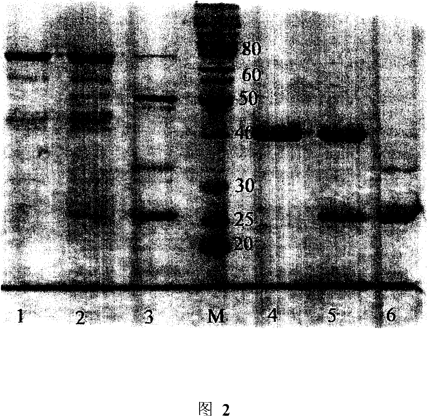 Cloning of Japanese blood fluke vaccine antigen gene and its expression and application