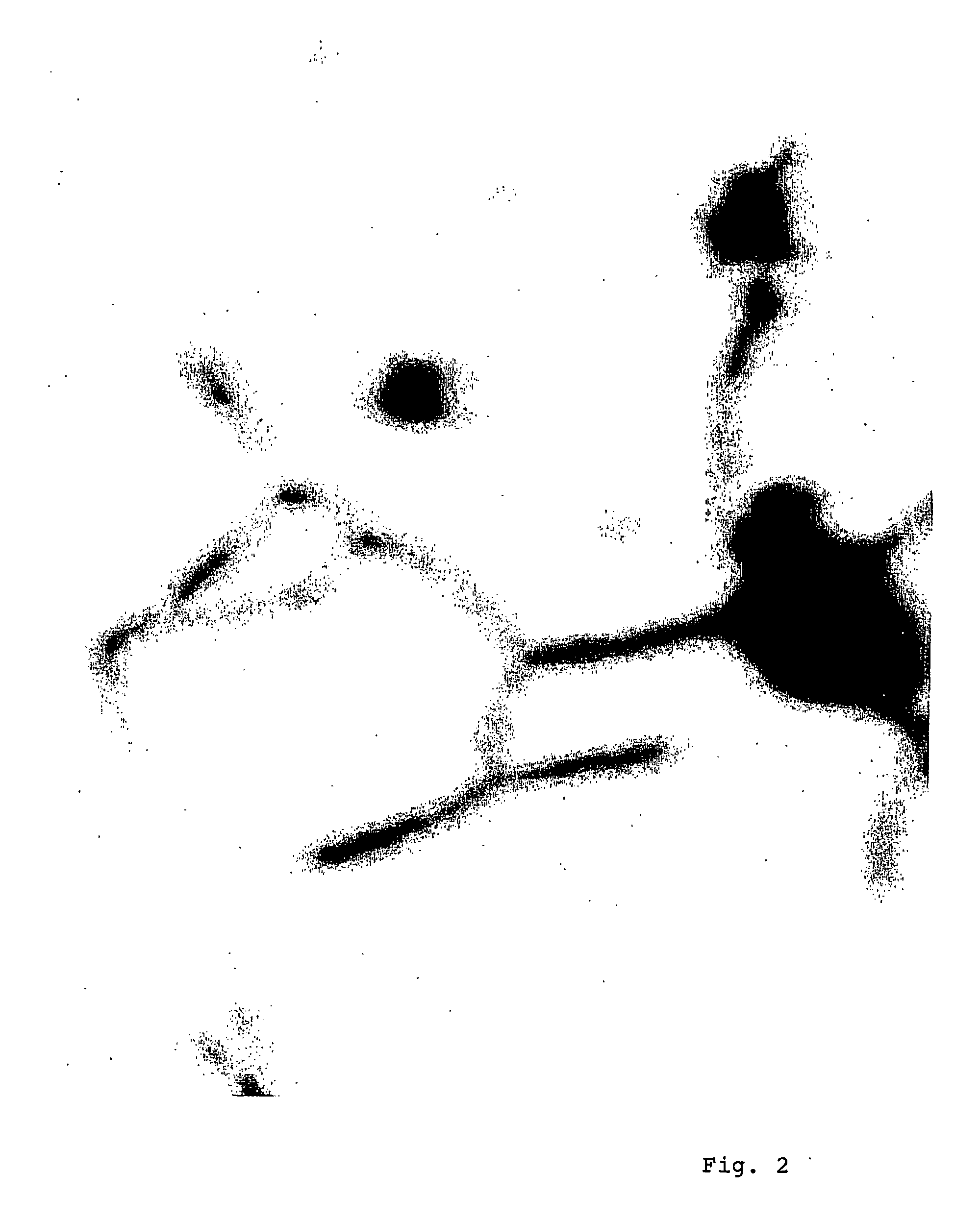 Use of mannosamine derivatives for the stimulation of neurite growth