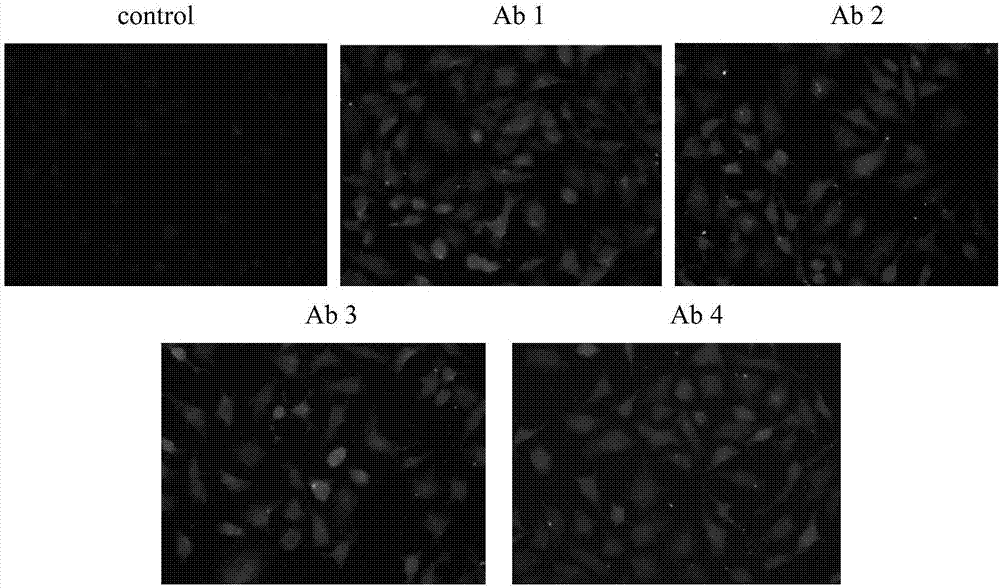 High-specificity and high-sensitivity monoclonal antibody for detecting human alpha-fetoprotein as well as reagent kit and application