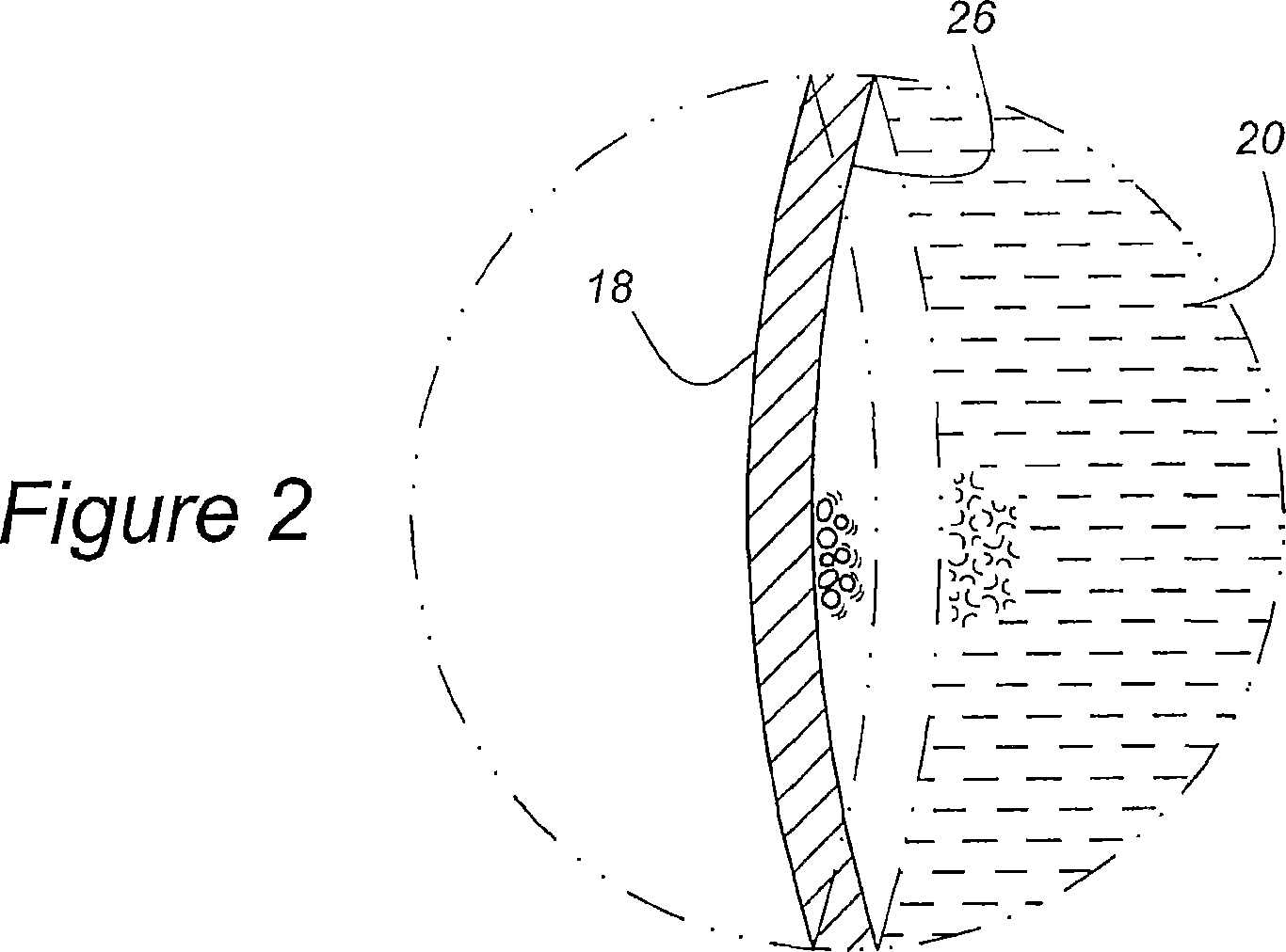 Anti-cavitation diesel cylinder liner