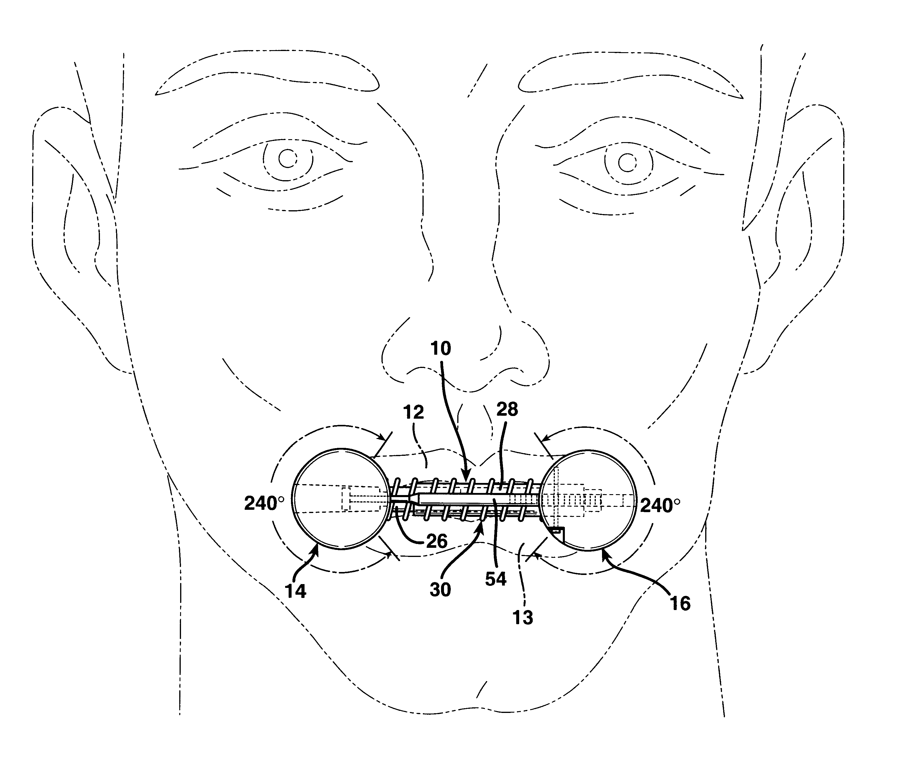 Facial muscle exercising device