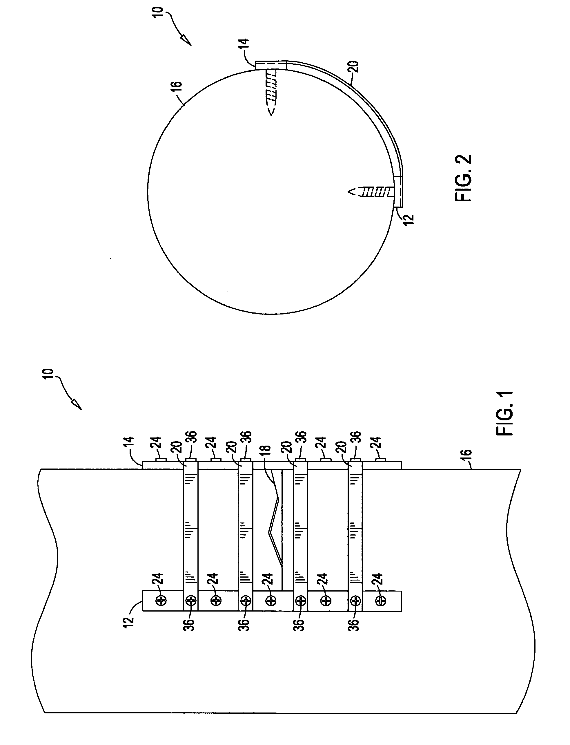 Method and device for treatment of orthopedic fractures