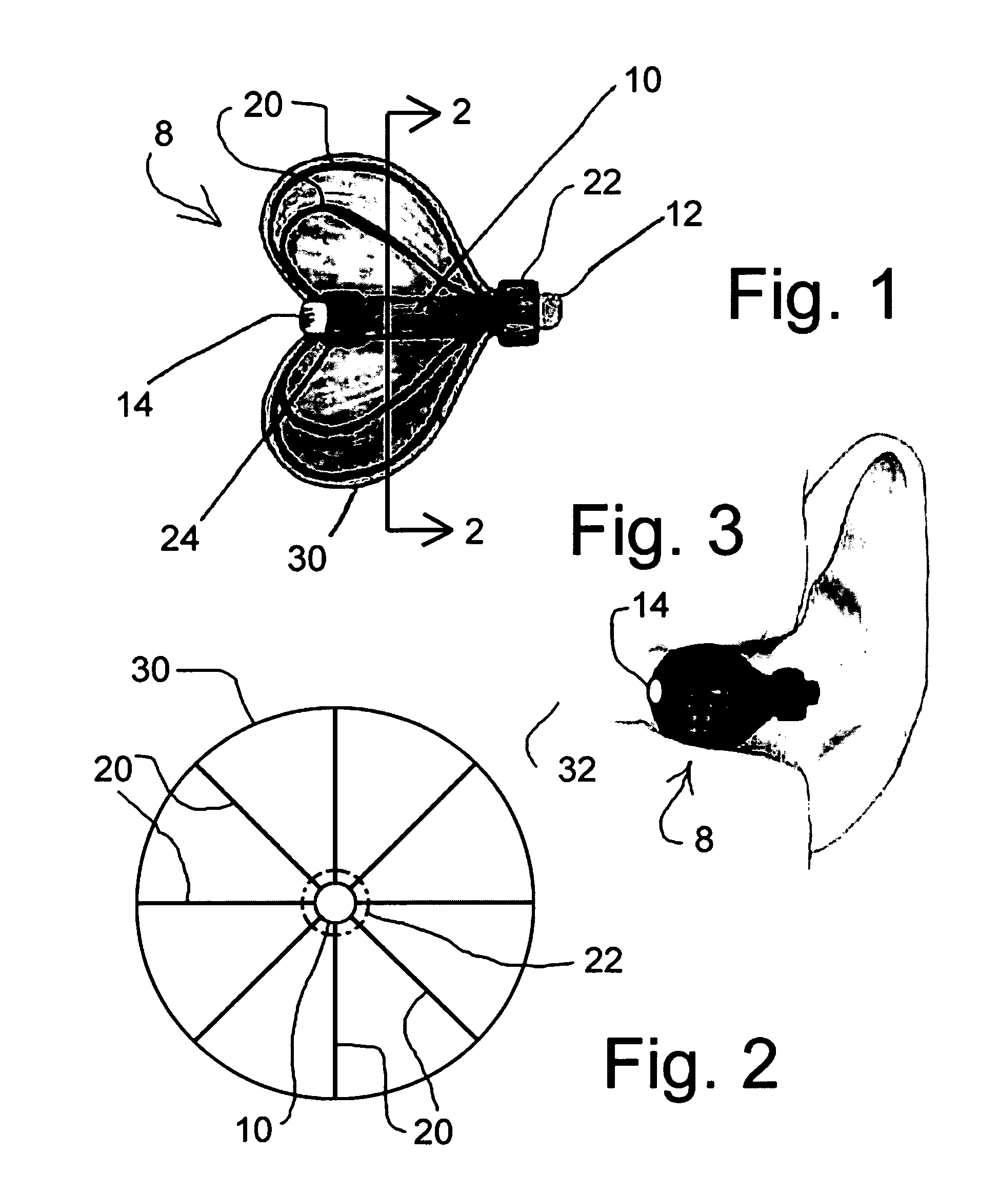 Balloon-expandable hearing device fitting system and self-expanding hearing device