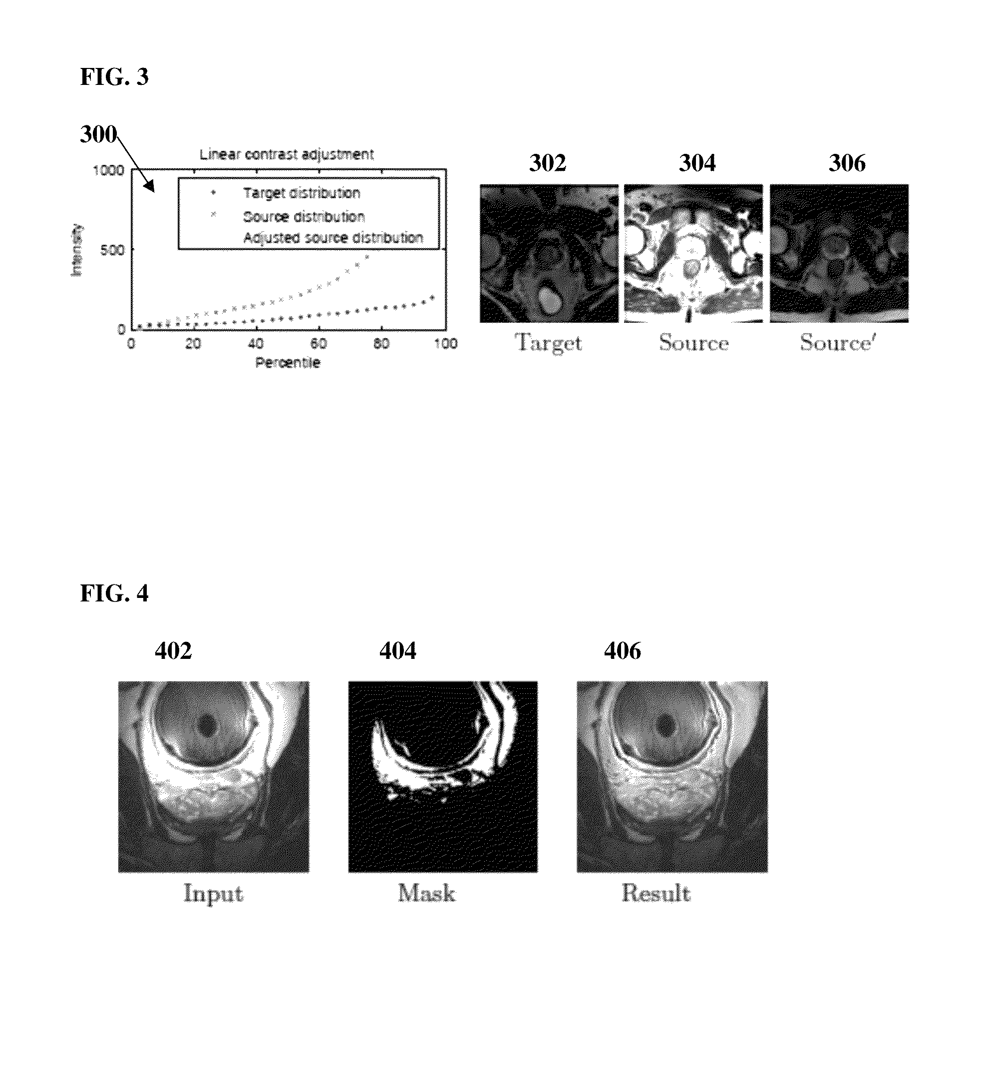 Method and system for automatic prostate segmentation in magnetic resonance images