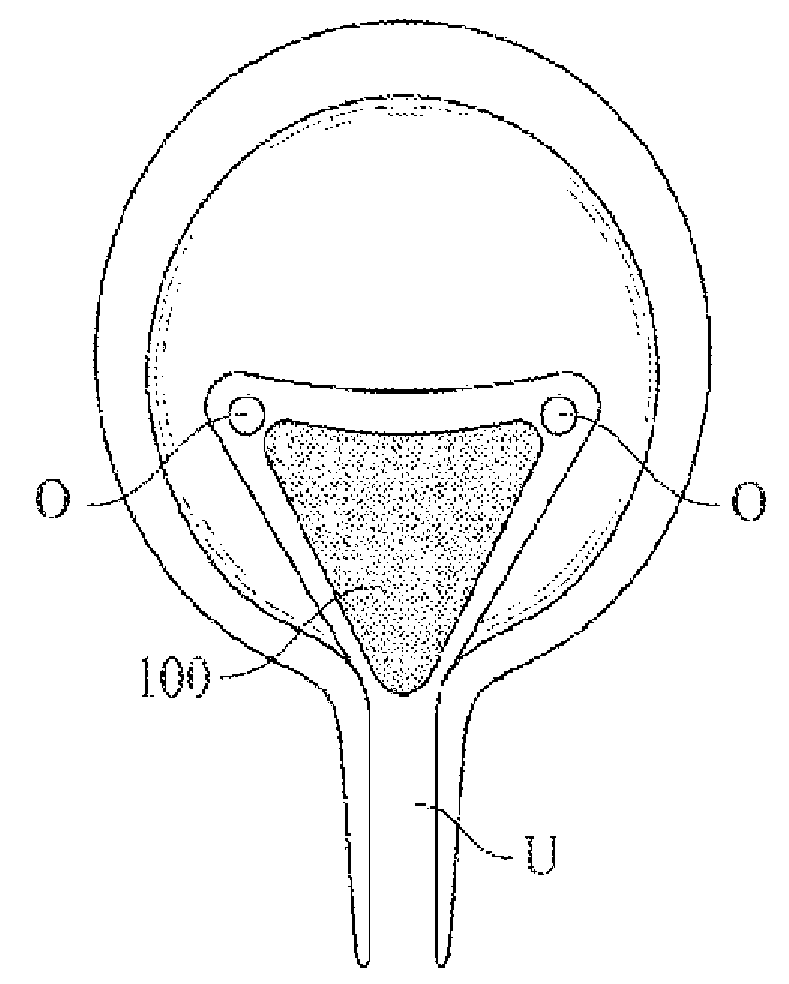 Apparatus and methods to modulate pelvic nervous tissue