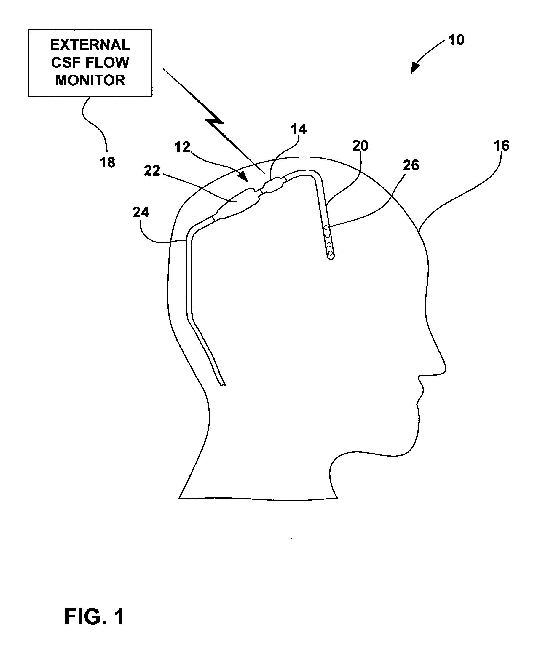 Cerebral spinal fluid flow sensing device