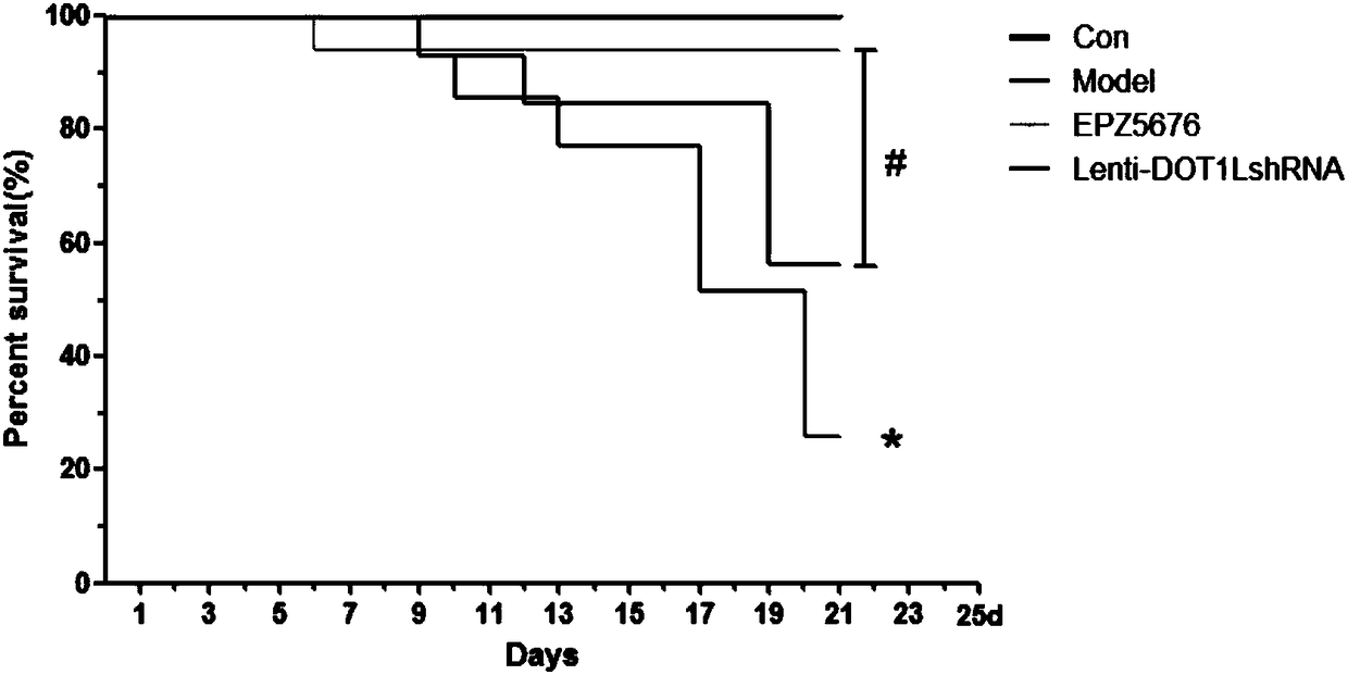 Application of compound EPZ5676 and related inhibitor thereof in preparing drug for preventing and treating pulmonary fibrosis diseases