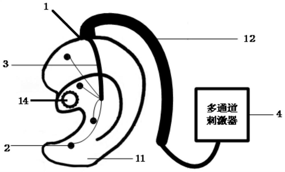 Earplug type auricular point electrode stimulation device