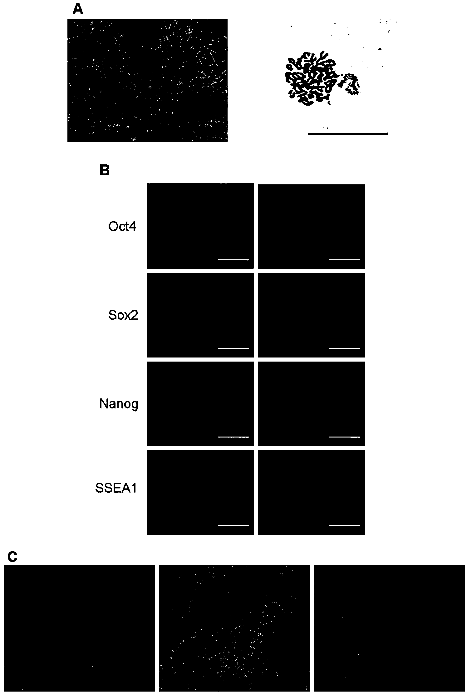 Method and culture media for inducing osteogenic differentiation of induced pluripotent stem cell of mouse