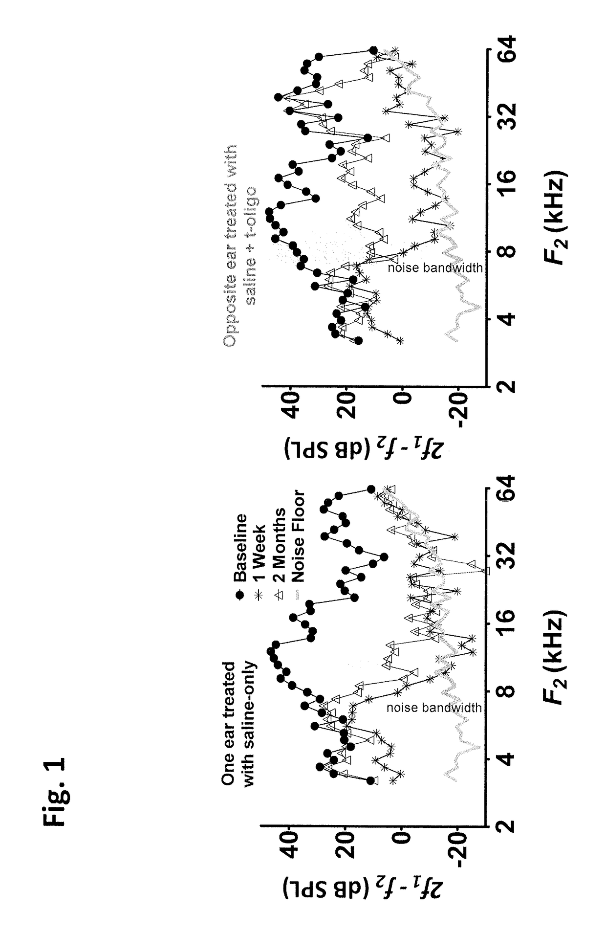 Methods of treating, inhibiting and/or preventing an auditory impairment