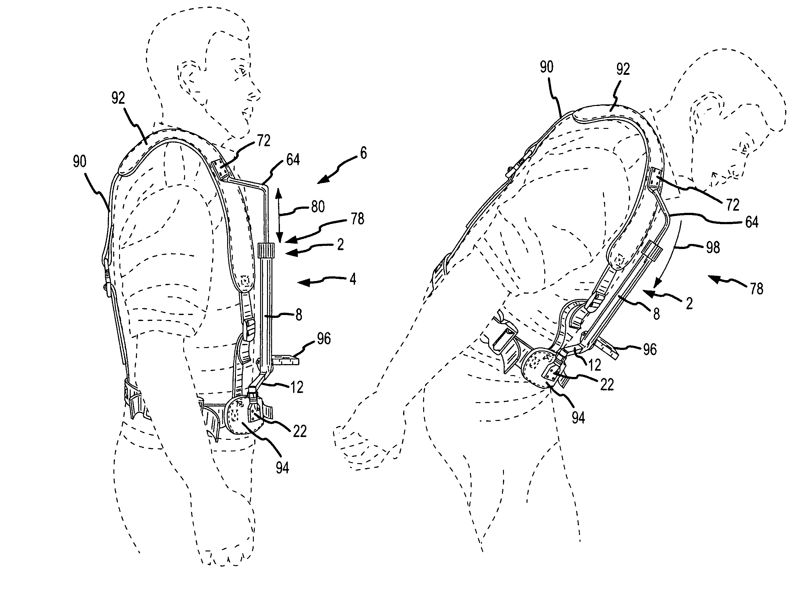 System for carrying articles at the front torso of a human being