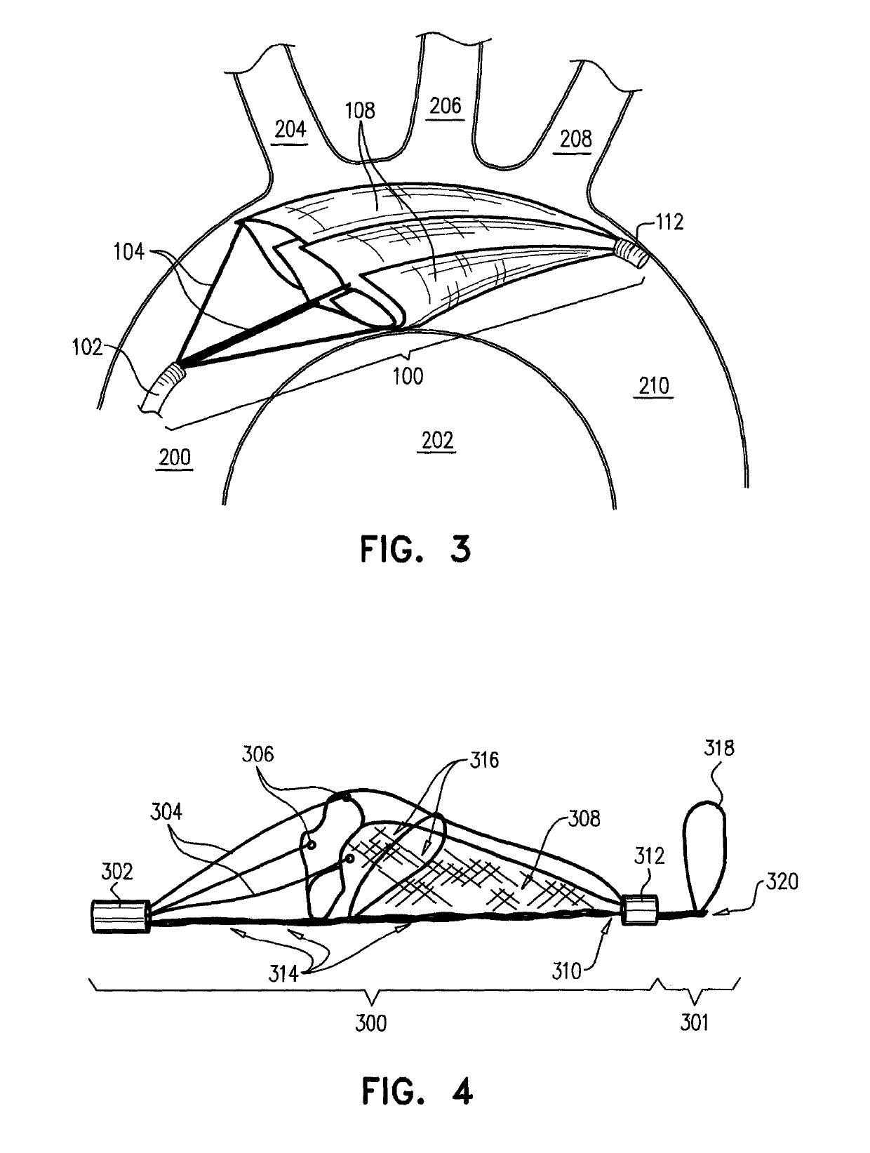 Intravascular device with multiple leaflets