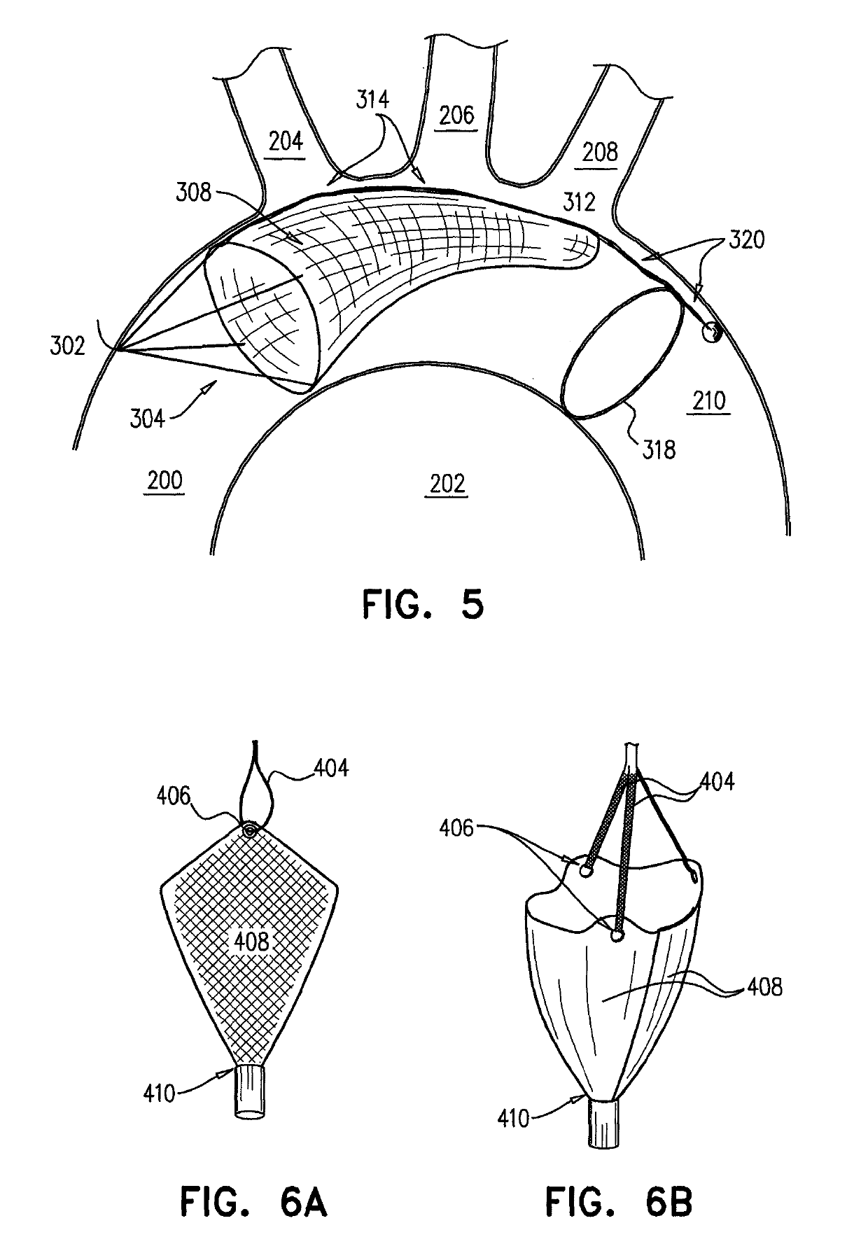 Intravascular device with multiple leaflets