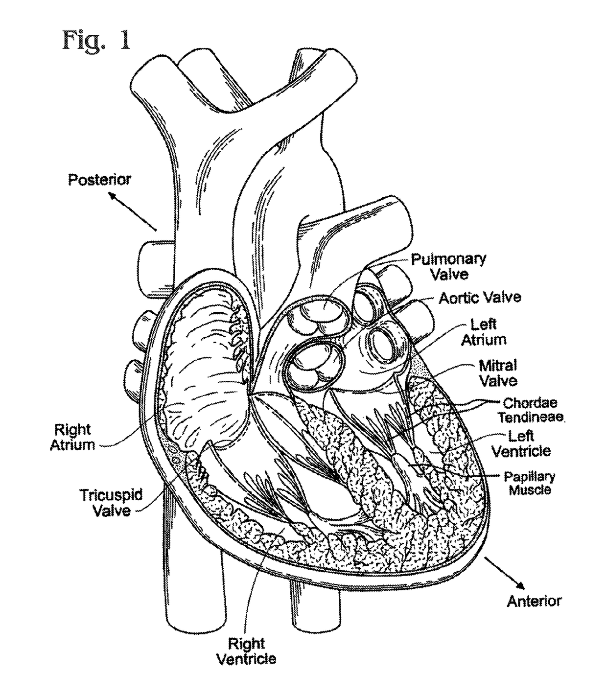 Methods of delivery of flexible heart valves