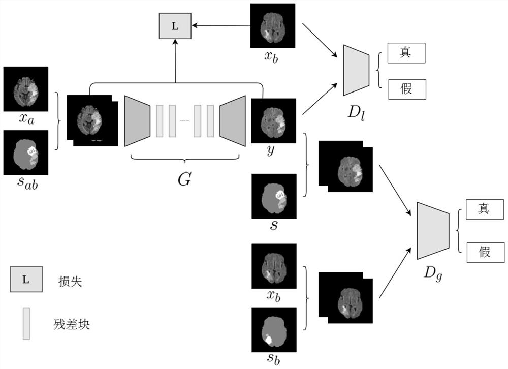 Brain tumor segmentation data enhancement method based on generative adversarial network