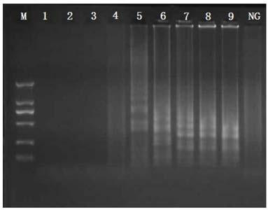 CPA primer, kit and detection method for escherichia coli O157:H7