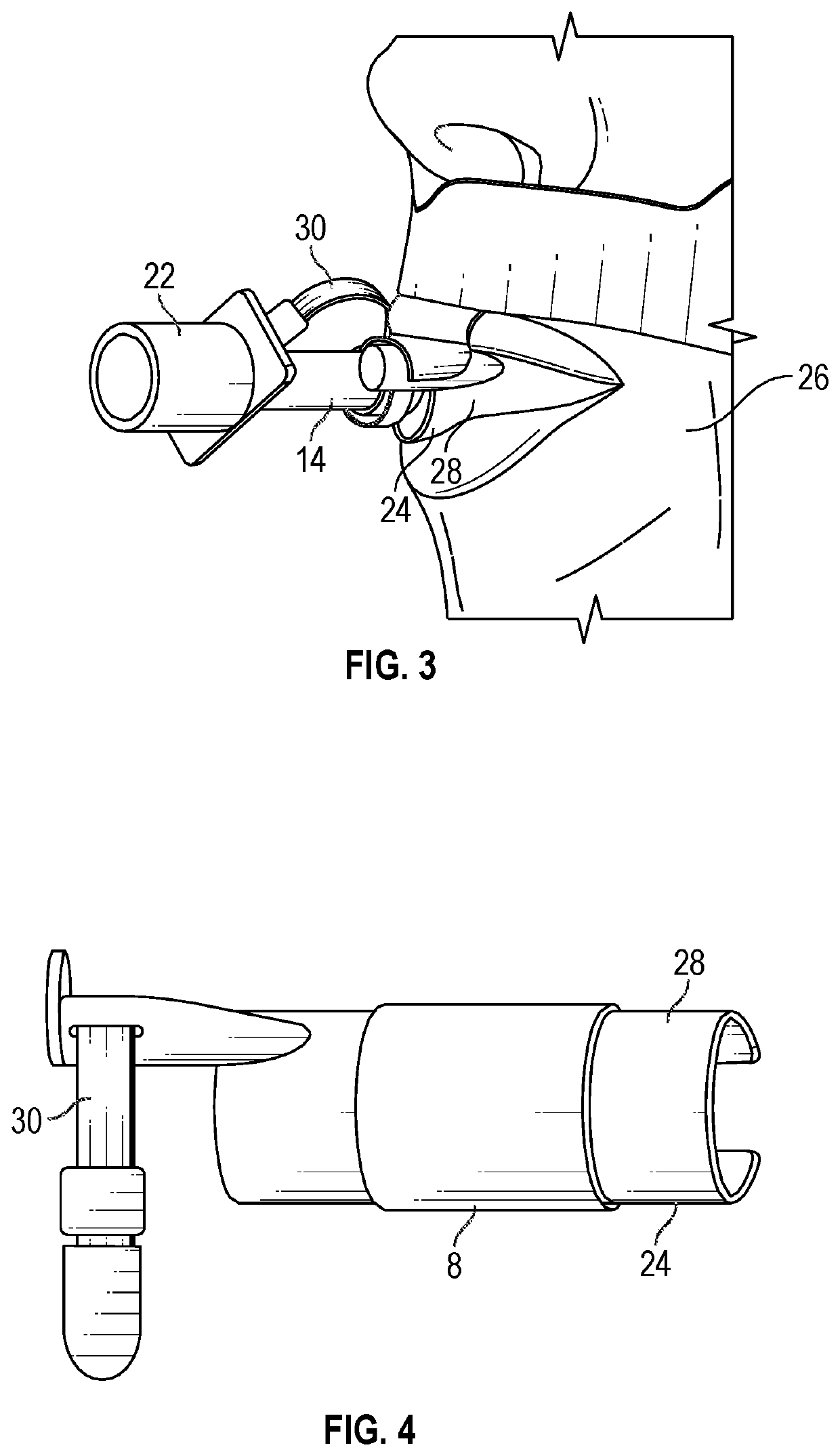 System and method for detecting agitation, discomfort and/or self-extubation during intubation