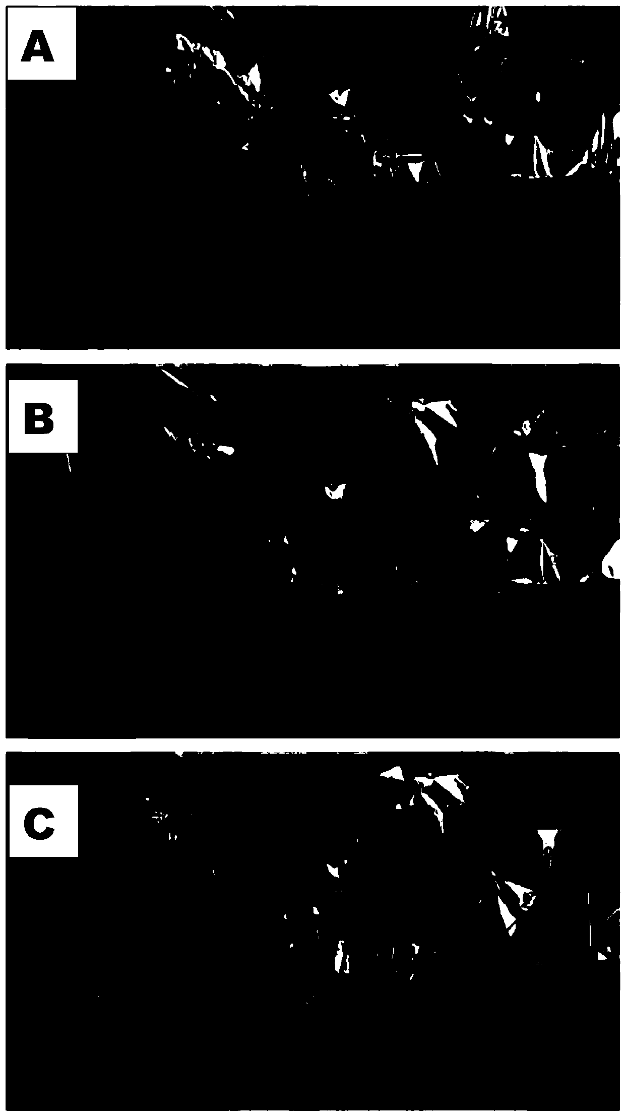 Biological antifugal liquid preparation with microorganism pythium oligandrum and method of production