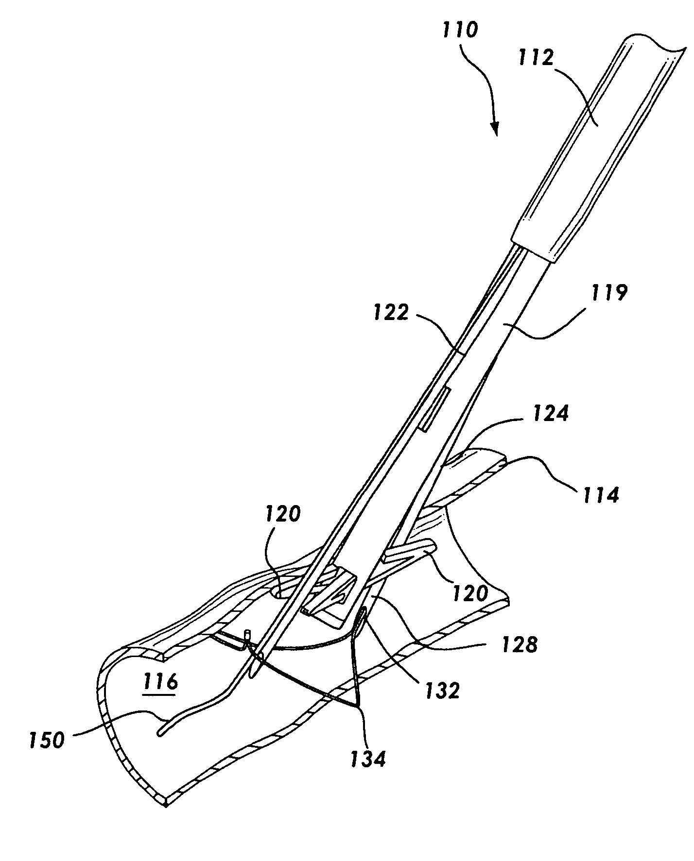 Suture based vascular closure apparatus and method incorporating a pre-tied knot