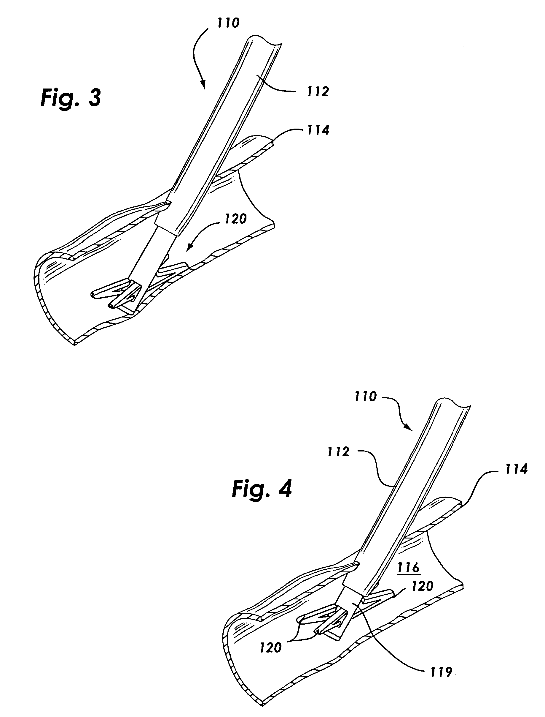 Suture based vascular closure apparatus and method incorporating a pre-tied knot
