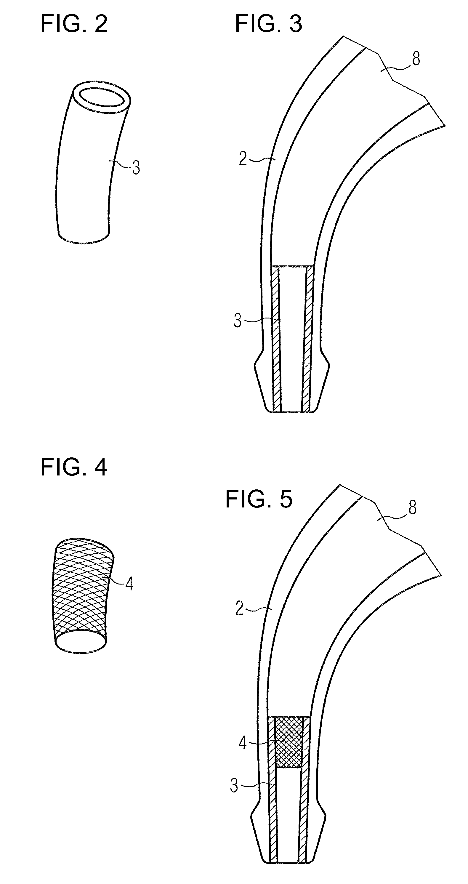 Configuration with a Wearing Hook for Hearing Devices and Associated Method