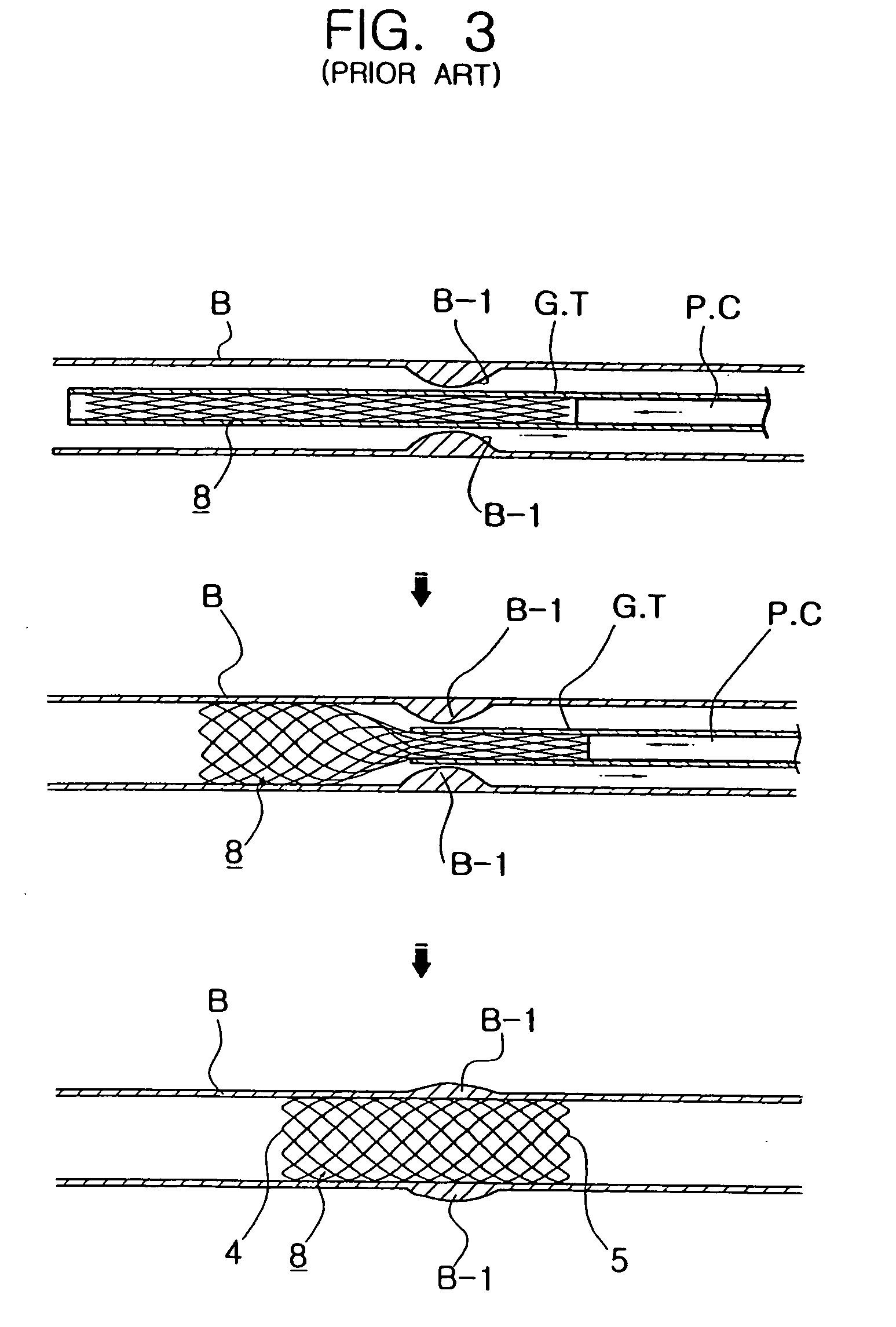 Flexible self-expandable stent using a shape memory alloy and method and apparatus for fabricating the same