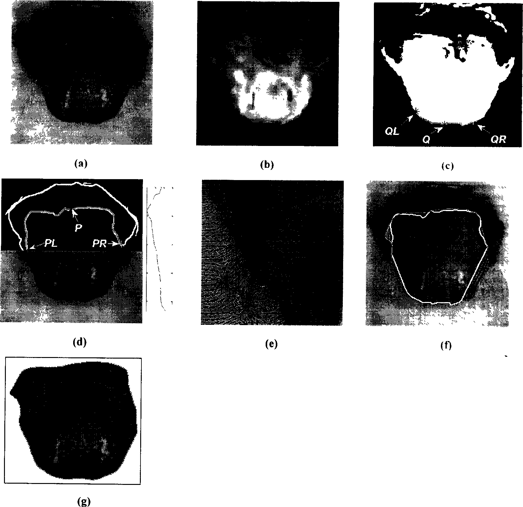 Method for extracting tongue body from tongue images